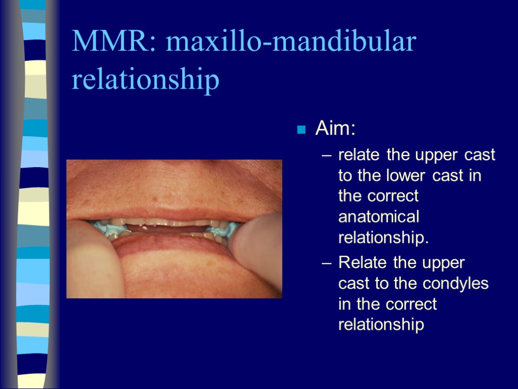 MMR: maxillo-mandibular relationship Aim: relate the upper cast to the lower cast in the